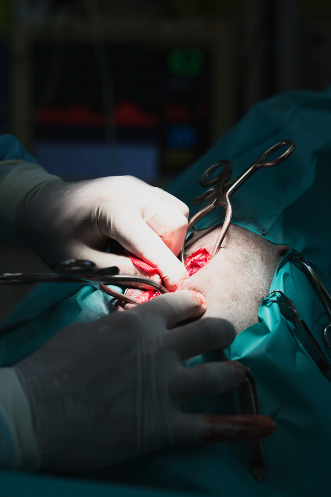 Lower Back Pain Surgery