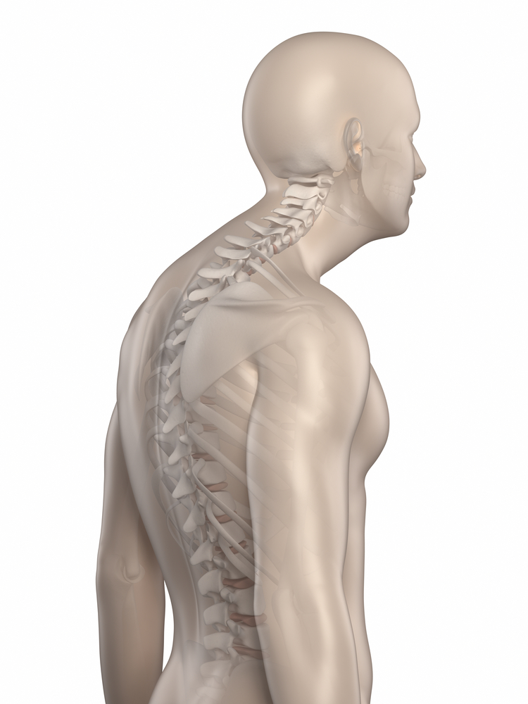 Kyphosis