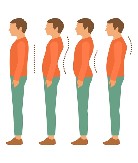 Correct Standing Posture